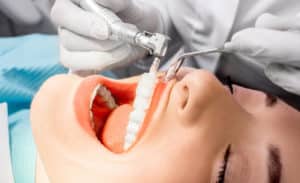 Cosmetic Dentistry Bluffton SC