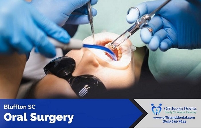 oral Surgery Bluffton SC