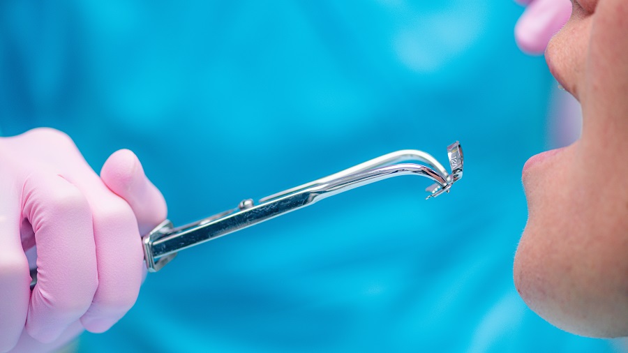 Best Bluffton SC Root Canal Therapy